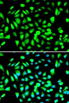 PRMT5 Antibody - Immunofluorescence analysis of A549 cell using PRMT5 antibody. Blue: DAPI for nuclear staining.