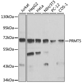 PRMT5 Antibody - Western blot analysis of extracts of various cell lines, using PRMT5 antibody at 1:1000 dilution. The secondary antibody used was an HRP Goat Anti-Rabbit IgG (H+L) at 1:10000 dilution. Lysates were loaded 25ug per lane and 3% nonfat dry milk in TBST was used for blocking. An ECL Kit was used for detection.