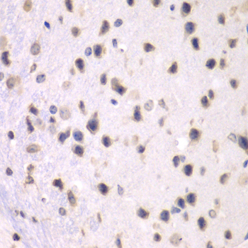 PRMT5 Antibody - Immunohistochemistry of paraffin-embedded mouse brain using PRMT5 antibodyat dilution of 1:100 (40x lens).