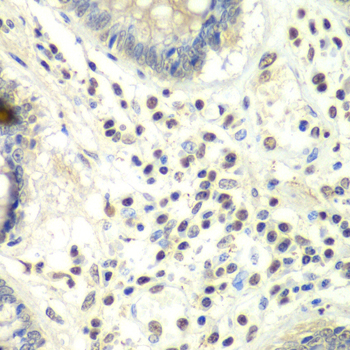 PRMT5 Antibody - Immunohistochemistry of paraffin-embedded human colon using PRMT5 antibodyat dilution of 1:100 (40x lens).