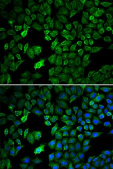 PRMT5 Antibody - Immunofluorescence analysis of U2OS cells using PRMT5 antibody. Blue: DAPI for nuclear staining.