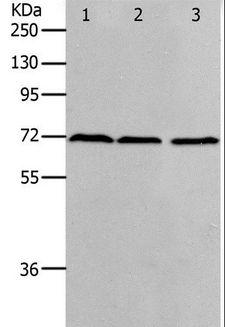 PRMT5 Antibody - Western blot analysis of K562, HeLa and 293T cell, using PRMT5 Polyclonal Antibody at dilution of 1:400.