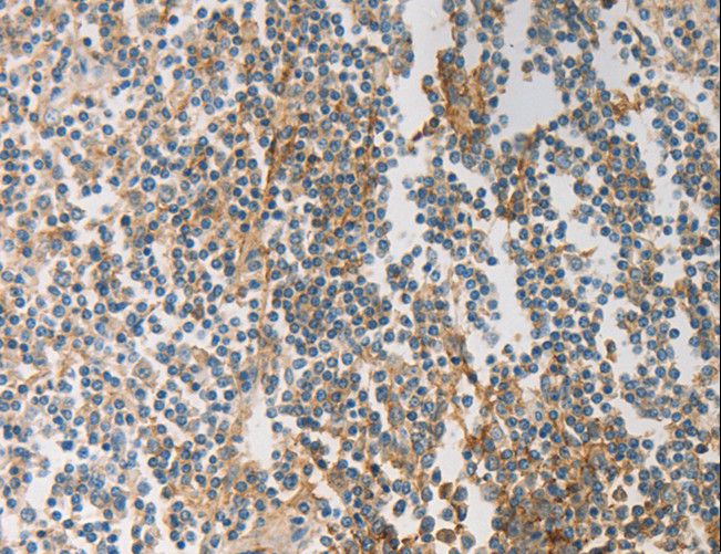 PRMT5 Antibody - Immunohistochemistry of paraffin-embedded Human tonsil using PRMT5 Polyclonal Antibody at dilution of 1:20.