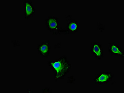PRMT5 Antibody - Immunofluorescent analysis of HeLa cells diluted at 1:100 and Alexa Fluor 488-congugated AffiniPure Goat Anti-Rabbit IgG(H+L)