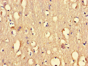 PRMT5 Antibody - Immunohistochemistry of paraffin-embedded human brain tissue at dilution of 1:100