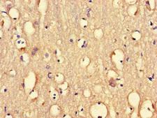 PRMT5 Antibody - Immunohistochemistry of paraffin-embedded human brain tissue at dilution of 1:100