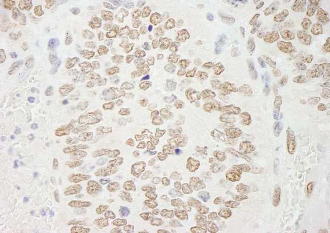 PRMT6 Antibody - Detection of Mouse PRMT6 by Immunohistochemistry. Sample: FFPE section of mouse teratoma. Antibody: Affinity purified rabbit anti-PRMT6 used at a dilution of 1:250. Epitope Retrieval Buffer-High pH (IHC-101J) was substituted for Epitope Retrieval Buffer-Reduced pH.