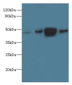 PRMT6 Antibody - Western blot. All lanes: PRMT6 antibody at 0.4 ug/ml. Lane 1: 293T whole cell lysate. Lane 2: MCF7 whole cell lysate. Lane 3: A431 whole cell lysate. Lane 4: K562 whole cell lysate. Secondary Goat polyclonal to Rabbit IgG at 1:10000 dilution. Predicted band size: 42 kDa. Observed band size: 42 kDa.