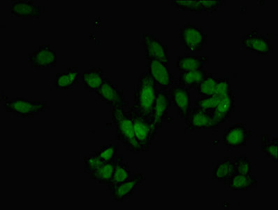 PRMT6 Antibody - Immunofluorescent analysis of Hela cells using PRMT6 Antibody at dilution of 1:100 and Alexa Fluor 488-congugated AffiniPure Goat Anti-Rabbit IgG(H+L)