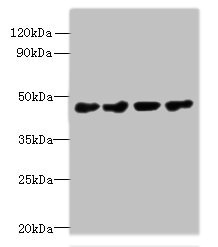 PRMT6 Antibody - Western blot All lanes: PRMT6 antibody at 0.4µg/ml Lane 1: 293T whole cell lysate Lane 2: MCF-7 whole cell lysate Lane 3: A431 whole cell lysate Lane 4: K562 whole cell lysate Secondary Goat polyclonal to rabbit IgG at 1/10000 dilution Predicted band size: 42, 33 kDa Observed band size: 42 kDa