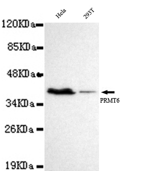 PRMT6 Antibody - Western blot detection of PRMT6 in Hel and 293T cell lysates using PRMT6 mouse monoclonal antibody (1:1000 dilution). Predicted band size: 42KDa. Observed band size: 42KDa.