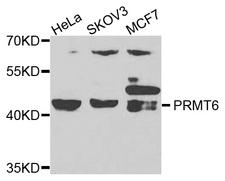 PRMT6 Antibody - Western blot analysis of extracts of various cells.