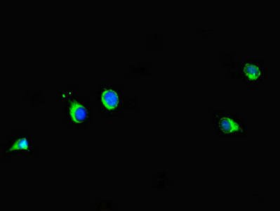 PRMT6 Antibody - Immunofluorescent analysis of HeLa cells diluted at 1:100 and Alexa Fluor 488-congugated AffiniPure Goat Anti-Rabbit IgG(H+L)