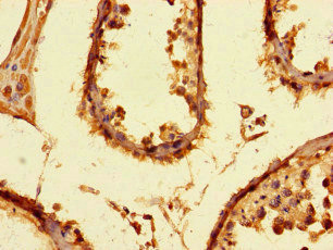 PRMT6 Antibody - Immunohistochemistry of paraffin-embedded human testis tissue at dilution of 1:100
