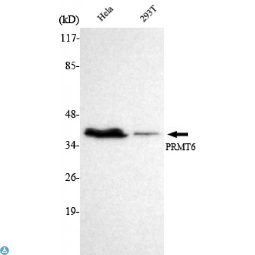 PRMT6 Antibody - Western Blot (WB) analysis using PRMT6 Monoclonal Antibody against HeLa, 293T cell lysate.