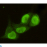 PRMT6 Antibody - Immunofluorescence (IF) analysis of HeLa cells using PRMT6 Monoclonal Antibody.