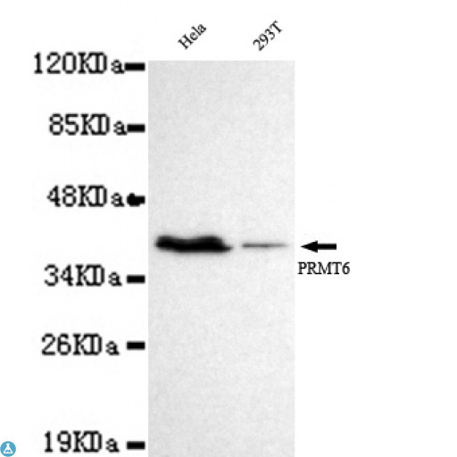 PRMT6 Antibody - Western blot detection of PRMT6 in Hel and 293T cell lysates using PRMT6 mouse mAb (1:1000 diluted). Predicted band size: 42KDa. Observed band size: 42KDa.