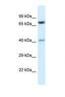 PRMT7 Antibody - PRMT7 antibody Western blot of Mouse Thymus lysate. Antibody concentration 1 ug/ml.  This image was taken for the unconjugated form of this product. Other forms have not been tested.