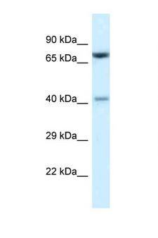 PRMT7 Antibody - PRMT7 antibody Western blot of Mouse Thymus lysate. Antibody concentration 1 ug/ml.  This image was taken for the unconjugated form of this product. Other forms have not been tested.