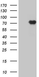 PRMT7 Antibody - HEK293T cells were transfected with the pCMV6-ENTRY control. (Left lane) or pCMV6-ENTRY PRMT7. (Right lane) cDNA for 48 hrs and lysed. Equivalent amounts of cell lysates. (5 ug per lane) were separated by SDS-PAGE and immunoblotted with anti-PRMT7. (1:2000)