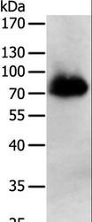 PRMT7 Antibody - Western blot analysis of Human liver cancer tissue, using PRMT7 Polyclonal Antibody at dilution of 1:500.