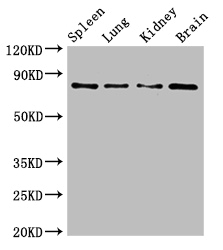PRMT7 Antibody - Positive WB detected in:Mouse spleen tissue,Mouse lung tissue,Mouse kidney tissue,Mouse brain tissue;All lanes:PRMT7 antibody at 6.2ug/ml;Secondary;Goat polyclonal to rabbit IgG at 1/50000 dilution;Predicted band size: 79,63,74,64 kDa;Observed band size: 79 kDa;