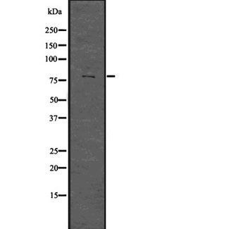 PRMT7 Antibody - Western blot analysis of PRMT7 using K562 whole lysates.