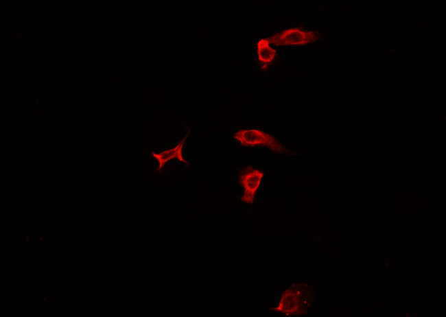 PRMT7 Antibody - Staining HepG2 cells by IF/ICC. The samples were fixed with PFA and permeabilized in 0.1% Triton X-100, then blocked in 10% serum for 45 min at 25°C. The primary antibody was diluted at 1:200 and incubated with the sample for 1 hour at 37°C. An Alexa Fluor 594 conjugated goat anti-rabbit IgG (H+L) antibody, diluted at 1/600, was used as secondary antibody.