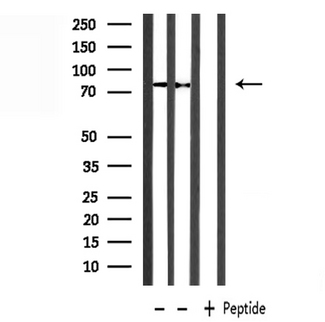 PRMT7 Antibody - Western blot analysis of extracts of mouse heart and rat lung using PRMT7 antibody.
