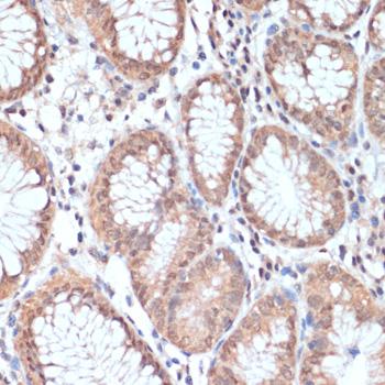 PRMT7 Antibody - Immunohistochemistry of paraffin-embedded Human stomach using PRMT7 Polyclonal Antibody at dilution of 1:200 (40x lens).