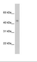 PRMT8 Antibody - Transfected 293T Cell Lysate.  This image was taken for the unconjugated form of this product. Other forms have not been tested.