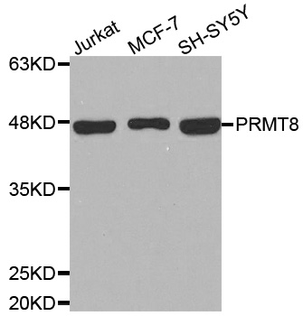 PRMT8 Antibody - Western blot analysis of extracts of various cell lines.