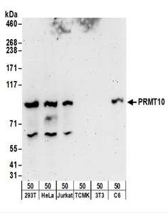PRMT9 / PRMT10 Antibody - Detection of Human and Rat PRMT10 by Western Blot. Samples: Whole cell lysate (50 ug) from 293T, HeLa, Jurkat, mouse TCMK-1, mouse NIH3T3, and rat C6 cells. Antibodies: Affinity purified rabbit anti-PRMT10 antibody used for WB at 0.4 ug/ml. Detection: Chemiluminescence with an exposure time of 3 minutes.