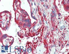 PRMT9 / PRMT10 Antibody - Human Placenta: Formalin-Fixed, Paraffin-Embedded (FFPE), at a concentration of 5 ug/ml. 