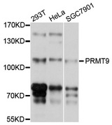 PRMT9 / PRMT10 Antibody - Western blot analysis of extracts of various cell lines, using PRMT9 antibody at 1:1000 dilution. The secondary antibody used was an HRP Goat Anti-Rabbit IgG (H+L) at 1:10000 dilution. Lysates were loaded 25ug per lane and 3% nonfat dry milk in TBST was used for blocking. An ECL Kit was used for detection and the exposure time was 5s.