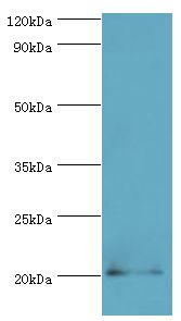 PRND / DOPPEL Antibody - Western blot. All lanes: Prion-like protein doppel antibody at 2 ug/ml+mouse spleen tissue. Secondary antibody: Goat polyclonal to rabbit at 1:10000 dilution. Predicted band size: 20 kDa. Observed band size: 20 kDa Immunohistochemistry.