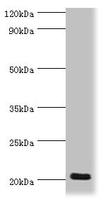 PRND / DOPPEL Antibody - Western blot All lanes: Prion-like protein doppel antibody at 2µg/ml + Mouse spleen tissue Secondary Goat polyclonal to rabbit IgG at 1/10000 dilution Predicted band size: 20 kDa Observed band size: 20 kDa