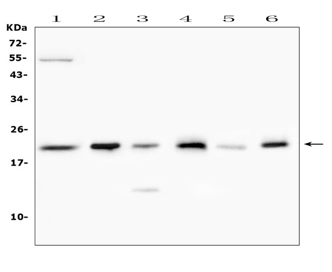 PRND / DOPPEL Antibody - Western blot analysis of Doppel using anti-Doppel antibody. Electrophoresis was performed on a 5-20% SDS-PAGE gel at 70V (Stacking gel) / 90V (Resolving gel) for 2-3 hours. The sample well of each lane was loaded with 50ug of sample under reducing conditions. Lane 1: human SHG-44 whole cell lysate,Lane 2: rat testis tissue lysates,Lane 3: rat kidney tissue lysates,Lane 4: mouse testis tissue lysates,Lane 5: mouse kidney tissue lysates,Lane 6: mouse brain tissue lysates. After Electrophoresis, proteins were transferred to a Nitrocellulose membrane at 150mA for 50-90 minutes. Blocked the membrane with 5% Non-fat Milk/ TBS for 1.5 hour at RT. The membrane was incubated with rabbit anti-Doppel antigen affinity purified polyclonal antibody at 0.5 µg/mL overnight at 4°C, then washed with TBS-0.1% Tween 3 times with 5 minutes each and probed with a goat anti-rabbit IgG-HRP secondary antibody at a dilution of 1:10000 for 1.5 hour at RT. The signal is developed using an Enhanced Chemiluminescent detection (ECL) kit with Tanon 5200 system. A specific band was detected for Doppel at approximately 23KD. The expected band size for Doppel is at 20KD.