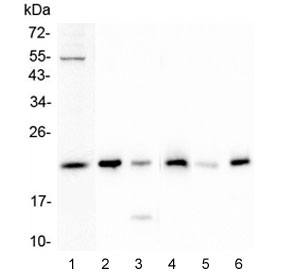PRND / DOPPEL Antibody - Western blot testing of 1) human SHG-44, 2) rat testis, 3) rat kidney, 4) mouse testis, 5) mouse kidney and 6) mouse brain lysate with Doppel antibody at 0.5ug/ml. Predicted molecular weight ~20 kDa.