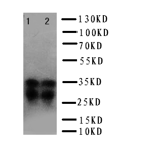 PRNP / PrP / Prion Antibody - WB of PRNP / PrP / Prion antibody. Lane 1: Rat Brain Tissue Lysate. Lane 2: Rat Brain Tissue Lysate.