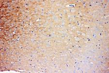 PRNP / PrP / Prion Antibody - PRNP / PrP / Prion antibody. IHC(P): Rat Brain Tissue.