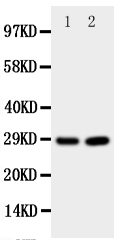 PRNP / PrP / Prion Antibody - Anti-PRNP antibody, Western blotting All lanes: Anti PRNP at 0.5ug/ml Lane 1: Rat Brain Tissue Lysate at 50ug Lane 2: Rat Brain Tissue Lysate at 50ug Predicted bind size: 28KD Observed bind size: 28KD