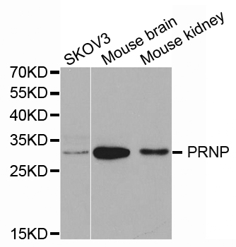 PRNP / PrP / Prion Antibody - Western blot analysis of extracts of various cell lines.