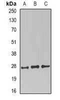 PRNP / PrP / Prion Antibody - Western blot analysis of CD230 expression in SKOV3 (A); mouse brain (B); mouse kidney (C) whole cell lysates.