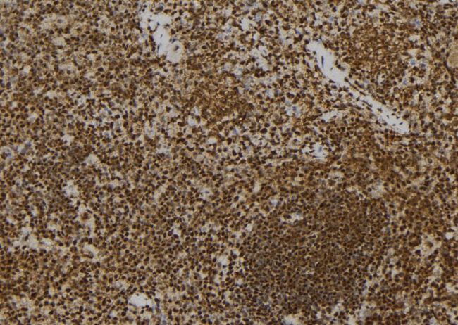 PRNP / PrP / Prion Antibody - 1:100 staining mouse spleen tissue by IHC-P. The sample was formaldehyde fixed and a heat mediated antigen retrieval step in citrate buffer was performed. The sample was then blocked and incubated with the antibody for 1.5 hours at 22°C. An HRP conjugated goat anti-rabbit antibody was used as the secondary.
