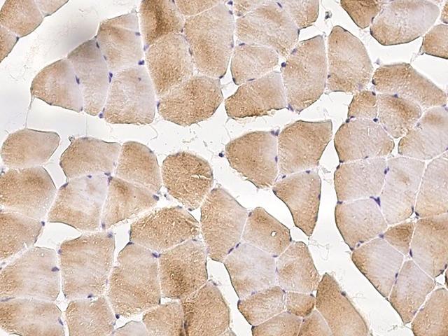 PROB1 Antibody - Immunochemical staining of human PROB1 in human skeletal muscle with rabbit polyclonal antibody at 1:100 dilution, formalin-fixed paraffin embedded sections.