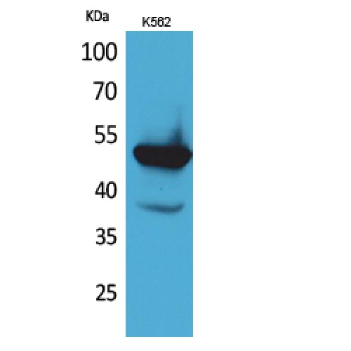 PROC / Protein C Antibody - Western blot of Protein C antibody