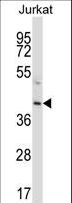 PROC / Protein C Antibody - PROC Antibody western blot of Jurkat cell line lysates (35 ug/lane). The PROC antibody detected the PROC protein (arrow).
