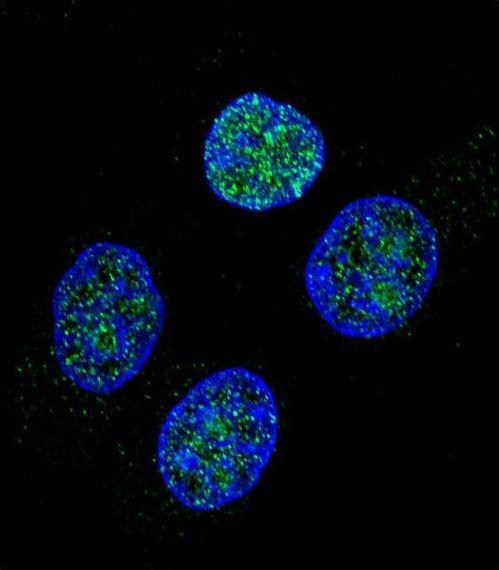 PROC / Protein C Antibody - Confocal immunofluorescence of PROC Antibody with HeLa cell followed by Alexa Fluor 488-conjugated goat anti-rabbit lgG (green). DAPI was used to stain the cell nuclear (blue).