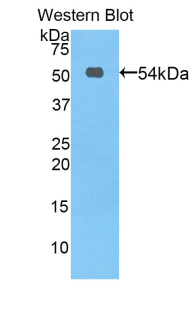 PROC / Protein C Antibody - Western blot of recombinant PROC / Protein C.  This image was taken for the unconjugated form of this product. Other forms have not been tested.